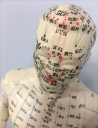 Acupuncture